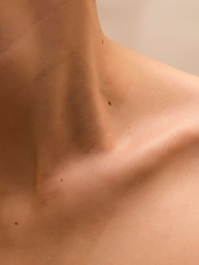 Bildausschnitt von nackter Haut an Hals und Schlüsselbein einer Person mit Muttermalen